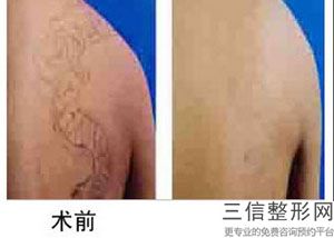 北京协和整形医院拉皮哪个医生做的好！黄渭清排名靠前