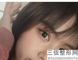 长春市哪家整形医院做双眼皮好！长春金妍医疗美容门诊部实力上榜