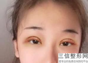 长春市哪家整形医院做双眼皮好！长春金妍医疗美容门诊部实力上榜