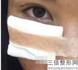 成都割双眼皮医院排名前十！成都米兰柏羽整形医院锁定前十