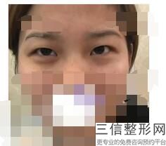 成都双眼皮医院排名前十！成都千和美汇医疗美容门诊部锁定前十