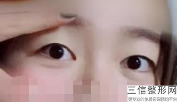 成都双眼皮医院排名前十！成都千和美汇医疗美容门诊部锁定前十