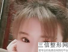 赤峰双眼皮整形医院排名榜五强！实力非凡
