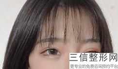 赤峰双眼皮整形医院排名榜五强！实力非凡