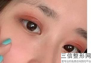 赤峰双眼皮整形医院排名榜五强！实力非凡