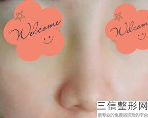赣州鼻子整形医院排名榜！位列前十