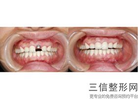 广州口腔优质整形医院排名！广州佳美口腔门诊部口碑不错