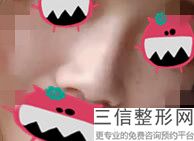 国内隆鼻医院排名！锁定前十