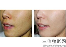 湖南做拉皮手术医院排名前十！长沙申美医疗美容门诊部实力超强