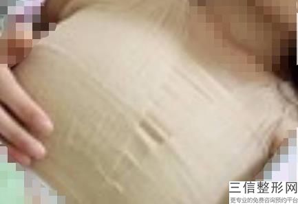 南京隆胸整形医院排行前十！南京江宁杰克斯医学美容诊所排名靠前