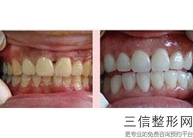 南京牙科医院排行榜！南京医科大学第四附属医院口腔科口碑良好