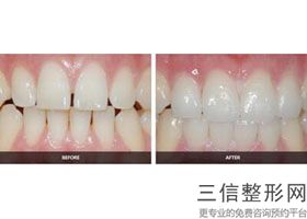 青岛口腔医院排名前十新版测评！青岛瑞泰口腔位列前十