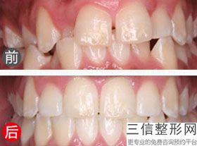 青岛口腔医院排名前十新版测评！青岛瑞泰口腔位列前十