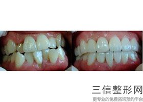 青岛口腔医院排名前十新版测评！青岛瑞泰口腔位列前十