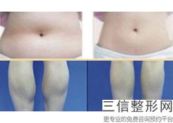 上海动氧瘦腹部医院排名!上海名格医疗整形美容门诊部位列前十
