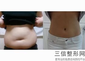 上海丰胸医院排名前十新版出炉！上海娜拉医疗美容门诊部实力非凡