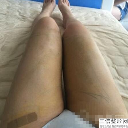 上海丰胸医院排名前十新版出炉！上海娜拉医疗美容门诊部实力非凡