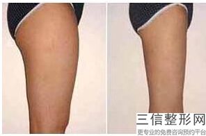 上海丰胸医院排名前十新版出炉！上海娜拉医疗美容门诊部实力非凡