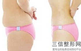 上海隔空溶脂瘦手臂医院排名！上海瑞阳整形美容医院锁定前十