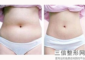 上海隔空溶脂瘦手臂医院排名！上海瑞阳整形美容医院锁定前十