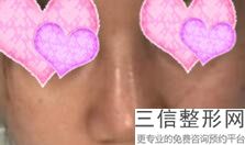 上海哪里做鼻子修复比较厉害!实力入围