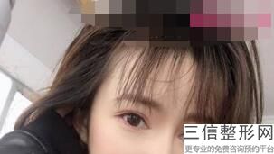深圳双眼皮医院排名前十拿捏住!深圳蓉悦医疗美容诊所实力入围