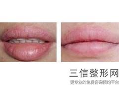 沈阳唇部整形医院排名前五哪家好！辽宁曙光整形外科医院首次上榜