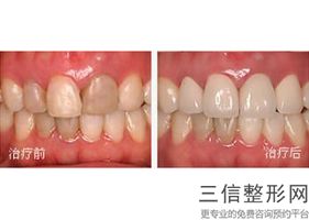 沈阳正规儿童牙科医院排名！沈阳欢乐仁爱口腔医院实力超强