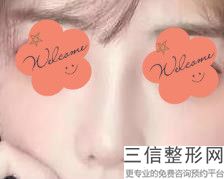 温州比较好的鼻部整形医院排名!温州加美整形美容医院实力超强