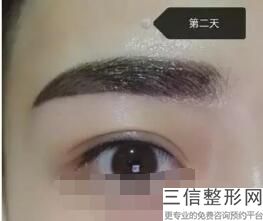 乌鲁木齐比较好的去眼袋整形机构排名！乌鲁木齐伊丽莎白整形美容医院首次上榜