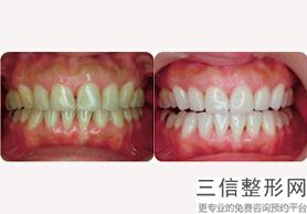 西安口腔医院排名榜前十新版宣布！ 西安小白兔口腔医院位列前十