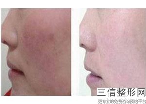 西安西京医院拉皮手术医生排名前五！口碑不错