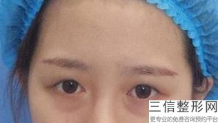 重庆双眼皮医院专业前十!重庆新桥医院整形美容中心实力入围