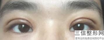 重庆双眼皮医院专业前十!重庆新桥医院整形美容中心实力入围