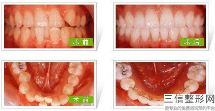 重庆优质口腔医院排名！遥遥领先