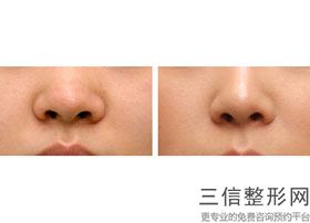 株洲比较好的肋骨隆鼻整形机构排名！湖南星薇美医疗美容有限公司实力入围