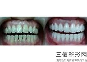 2022南京十大较好口腔医院！南京牙仙子口腔实力入围