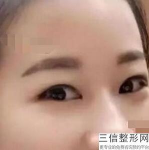 2022中国双眼皮整形医院排行榜前十！东莞华美整形医院实力入围
