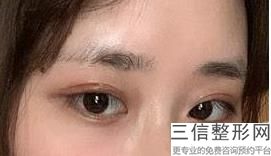 北京开眼角整形医院排名前十！北京丽都医疗整形医院实力超强