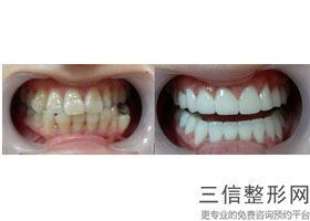 北京口腔医院排名前十人气汇总！北京禾禾口腔门诊部锁定前十