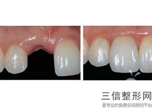 北京口腔医院排名前十新版出炉啦！北京协和医院口腔科排名靠前