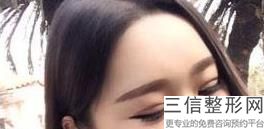 北京双眼皮整形医院排名前十盘点！北京星医汇医疗美容门诊部实力入围