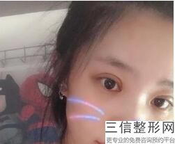 北京双眼皮整形医院排名前十盘点！北京星医汇医疗美容门诊部实力入围