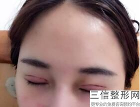 北京双眼皮整形医院排名前十盘点！北京星医汇医疗美容门诊部实力入围
