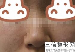 长沙做鼻子好的专家排名榜前三点评！口碑良好