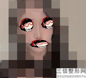 长沙做鼻子好的专家排名榜前三点评！口碑良好