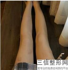 大连按摩紧致医院排名！大连瑞丽整形美容门诊部不容错过