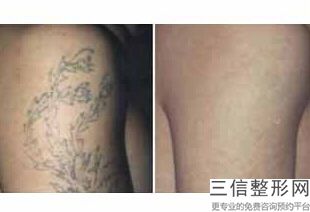 大连哪家医院做拉皮手术好的！大连孟亚君医疗美容首次上榜