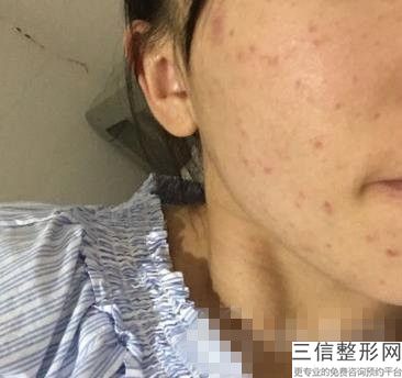 大连哪家医院做拉皮手术好的！大连孟亚君医疗美容首次上榜