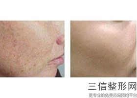 大连哪家医院做拉皮手术好的！大连孟亚君医疗美容首次上榜